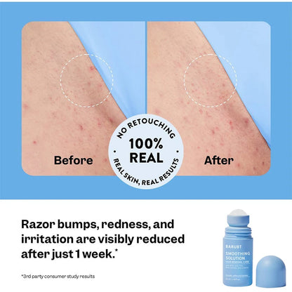 Jeunesse Élégante® Sérum Lissant Anti-Poils Incarnés